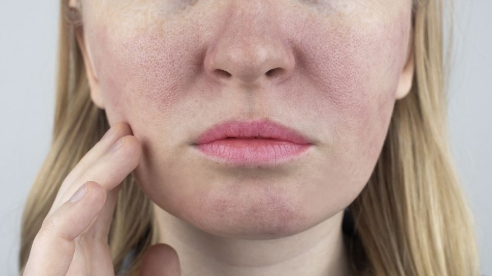 Bikin Wajah Glowing dalam 7 Hari! Inilah Cara dan Skincare yang Digunakan untuk Mengecilkan Pori-Pori