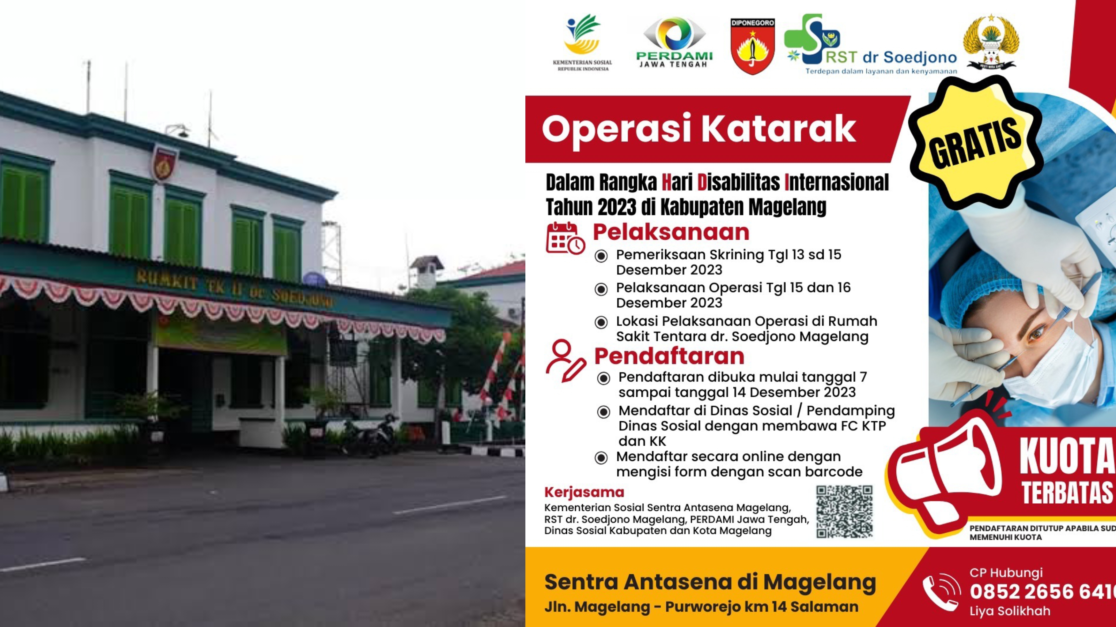 Sentra Antasena Magelang Gelar Operasi Katarak Gratis Bagi Warga Kabupaten dan Kota Magelang, Cek Tanggalnya