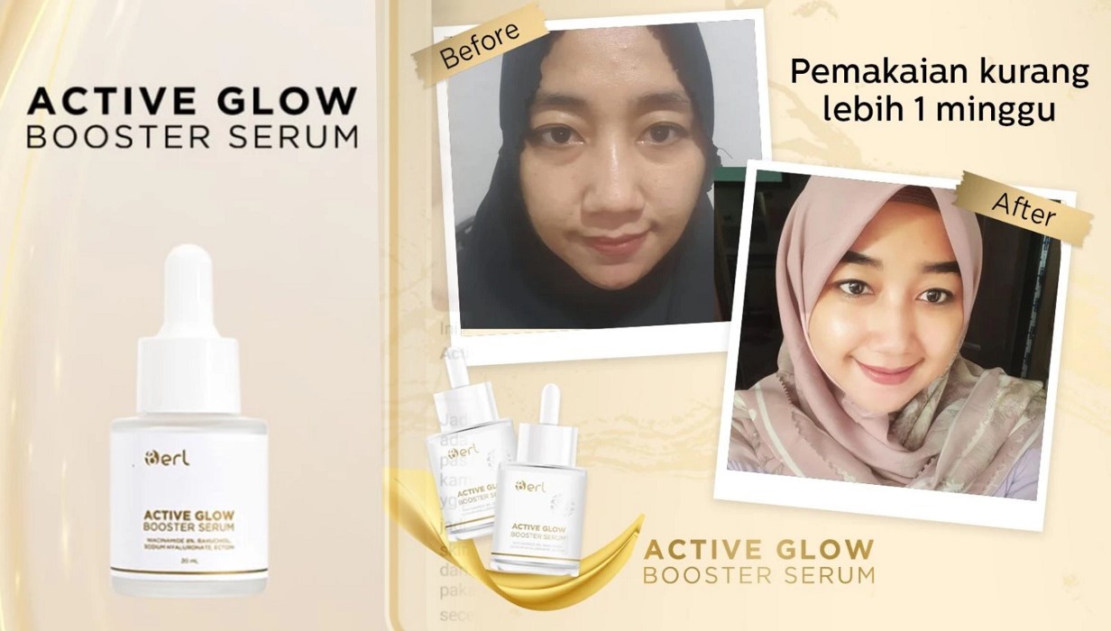 Kulit Nggak Cukup Dirawat, Harus Di-Boost