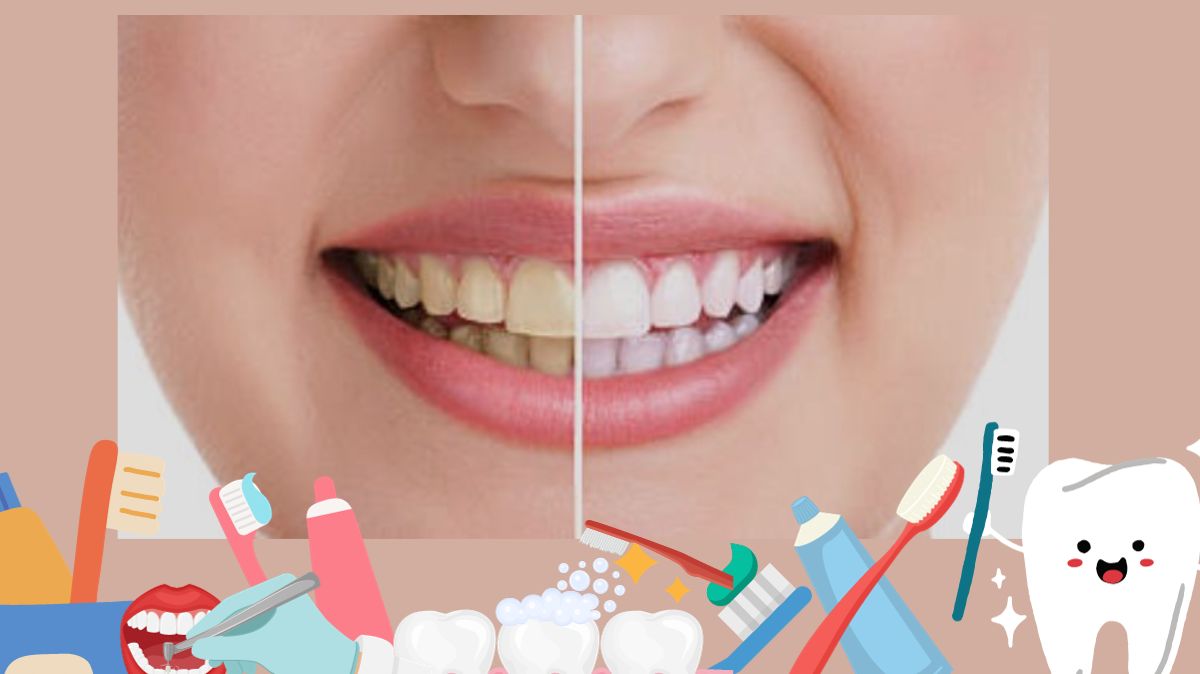 10 Cara Memutihkan Gigi Secara Alami dengan Bahan-Bahan yang Tersedia di Rumah