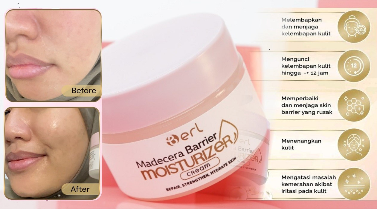 Kulit Kamu Bukan Manja, Tapi Lagi Minta Dilindungi