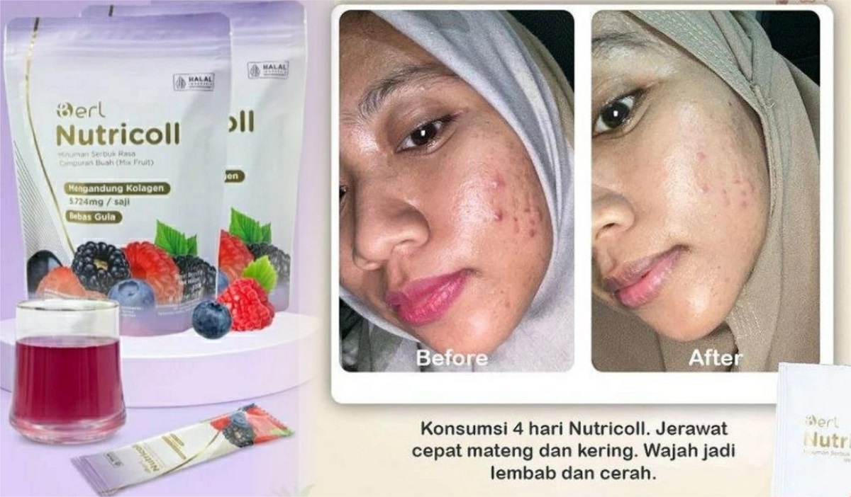 Kulit Cepat Kusam, Badan Mudah Capek, Tanda Penuaan Mulai Terlihat? Bisa Jadi Tubuhmu Kurang Asupan Kolagen