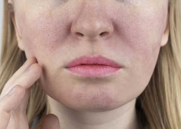 Bikin Wajah Glowing dalam 7 Hari! Inilah Cara dan Skincare yang Digunakan untuk Mengecilkan Pori-Pori
