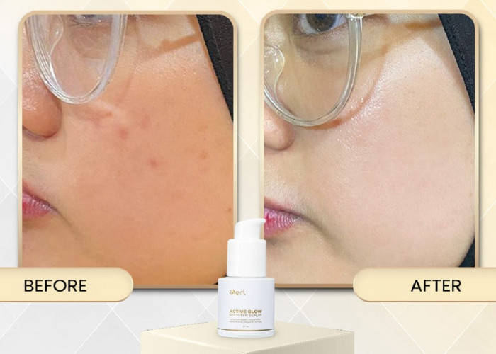 Pori Besar, Minyak Berlebih, dan Kulit Cepat Kusam? AGB dengan Niacinamide 8% & Bakuchiol Bisa Jadi Jawabannya