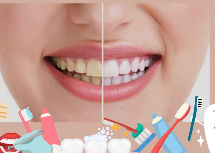 10 Cara Memutihkan Gigi Secara Alami dengan Bahan-Bahan yang Tersedia di Rumah