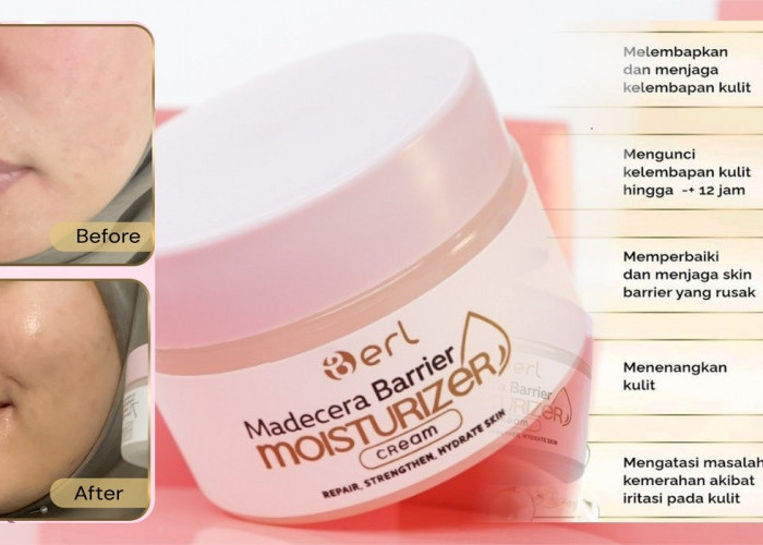 Kulit Kamu Bukan Manja, Tapi Lagi Minta Dilindungi