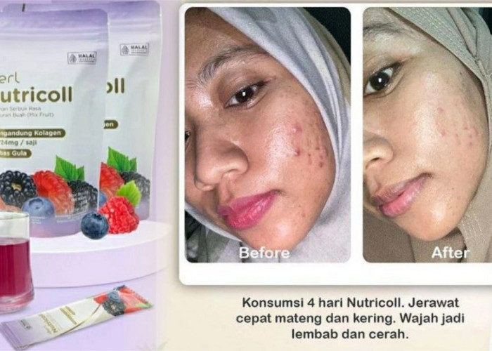 Kulit Cepat Kusam, Badan Mudah Capek, Tanda Penuaan Mulai Terlihat? Bisa Jadi Tubuhmu Kurang Asupan Kolagen