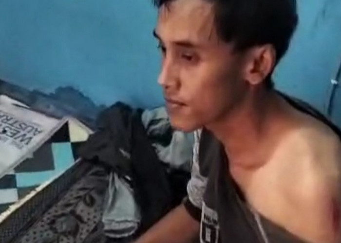 Jelang Pilkades Serentak, Pendukung Cakades di Ketitang Temanggung Diduga Jadi Korban Penganiayaan
