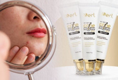 Rutinitas Kecil, Dampak Besar! Ini Cara Aman Bikin Jerawat Cepat Jinak Tanpa Iritasi