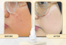 Pori Besar, Minyak Berlebih, dan Kulit Cepat Kusam? AGB dengan Niacinamide 8% & Bakuchiol Bisa Jadi Jawabannya