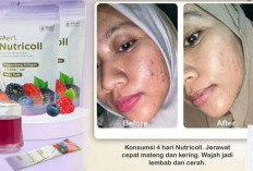 Kulit Cepat Kusam, Badan Mudah Capek, Tanda Penuaan Mulai Terlihat? Bisa Jadi Tubuhmu Kurang Asupan Kolagen